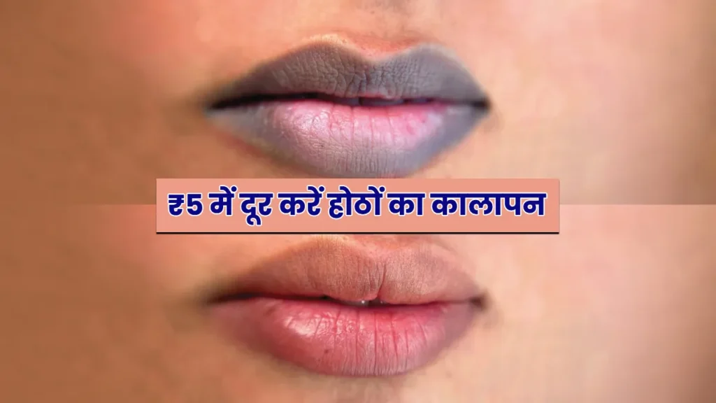 होठों का कालापन होगा दूर! बस रात में अपनाएं ये सस्ता और असरदार नुस्खा
